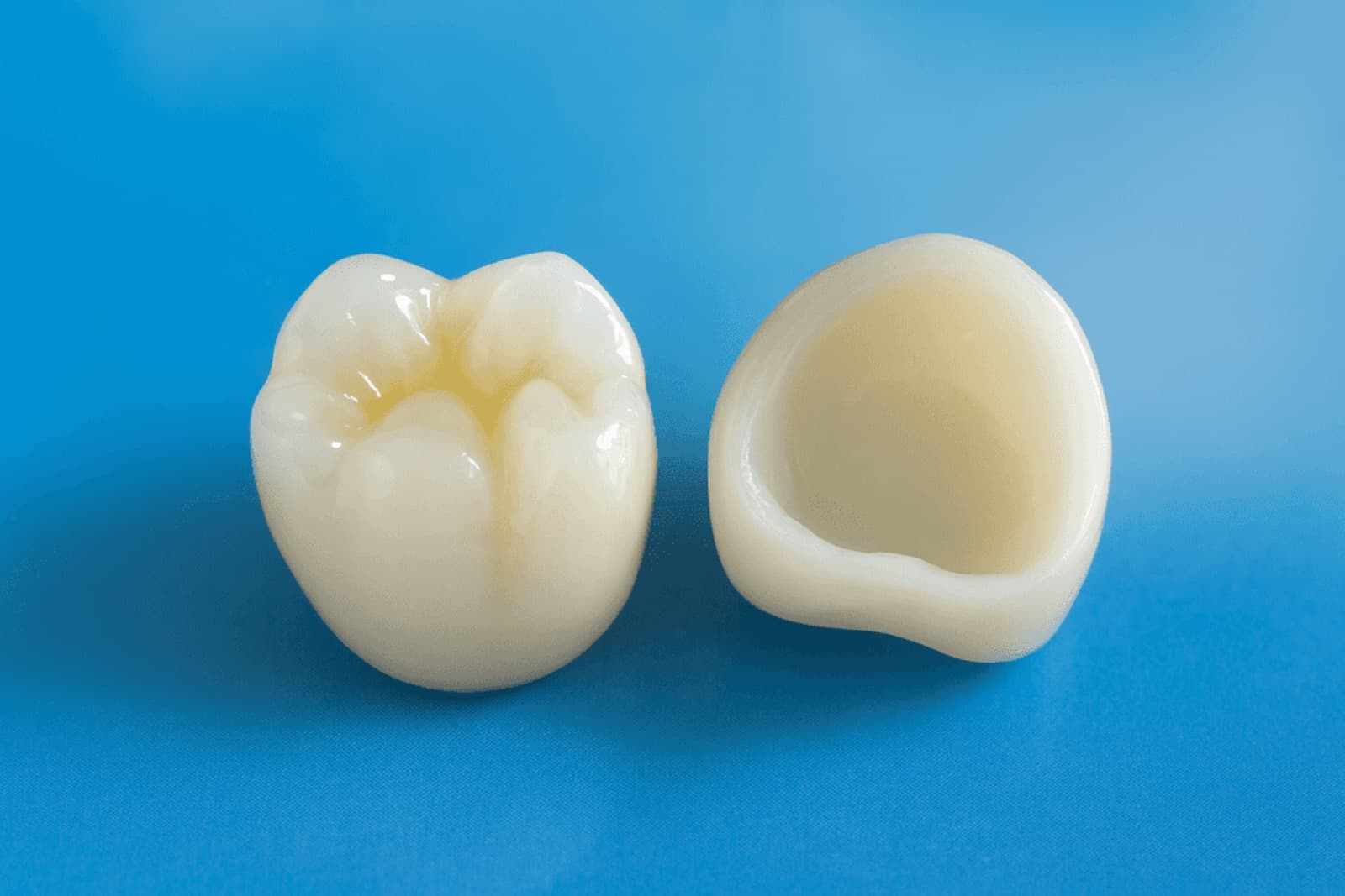 Prothèses conjointes — photo 2